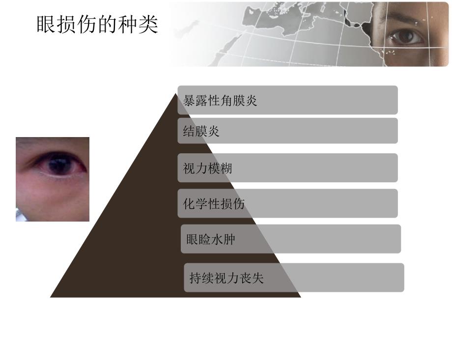 《术中眼保护措施》PPT课件_第3页