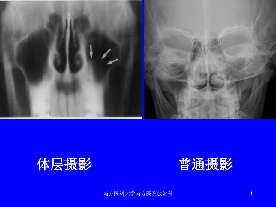 南方医科大学南方医院放射科课件_第4页