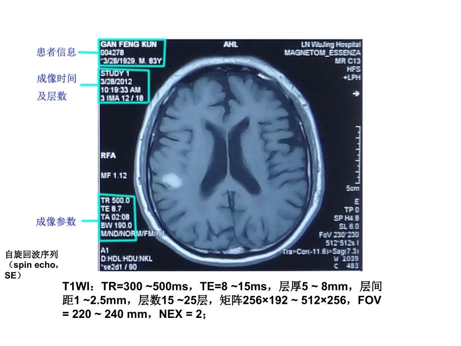 脑出血和脑梗塞的MRI课件_第3页