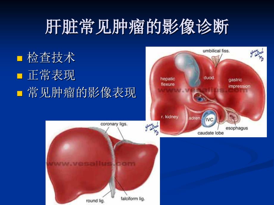 肝脏肿瘤的影像诊断_第2页