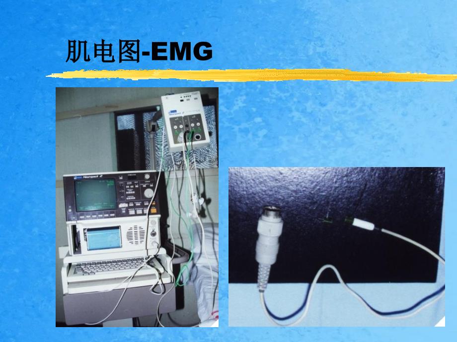 肌电图检测ppt课件_第3页