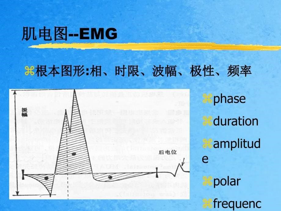 肌电图检测ppt课件_第5页