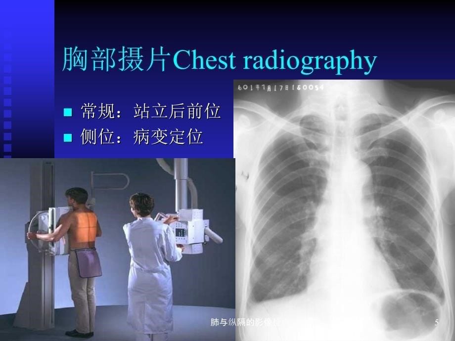 肺与纵隔的影像检查课件_第5页