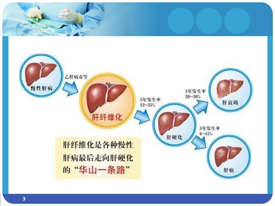 肝纤四项PPT参考幻灯片_第3页