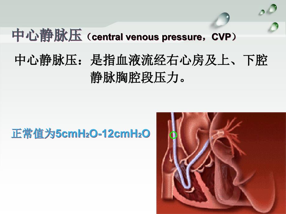 中心静脉压(CVP)的监测2_第4页