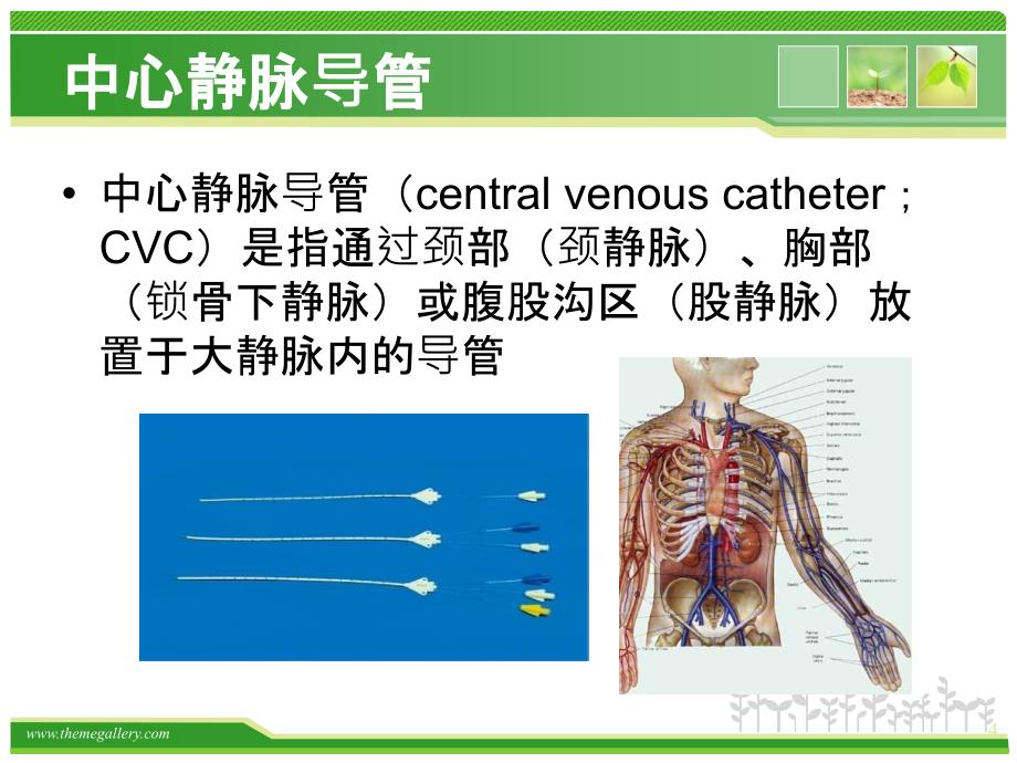 导管相关血栓(医院版).ppt_第4页