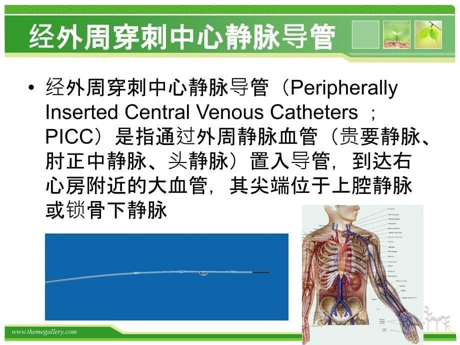 导管相关血栓(医院版).ppt_第5页