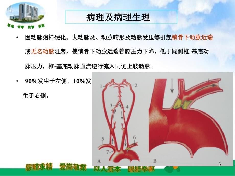 锁骨下动脉盗血优秀课件_第5页