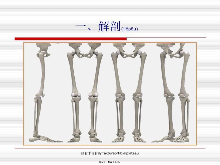 胫骨平台骨折fractureoftibialplateau课件_第5页