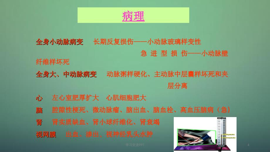 高血压病医学ppt课件_第4页