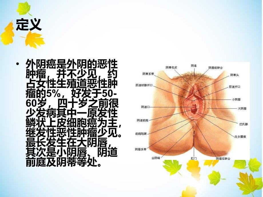 外阴癌的护理-1_第2页