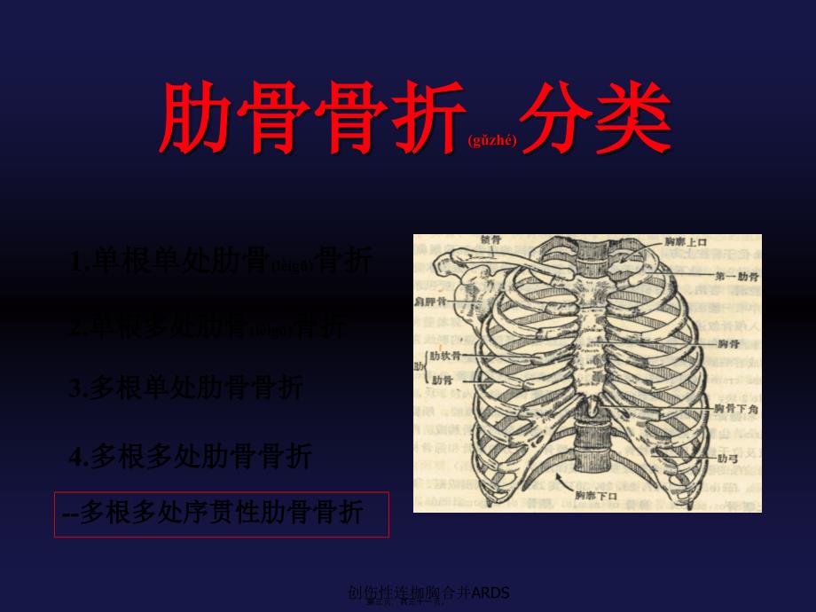 创伤性连枷胸合并ARDS课件_第3页