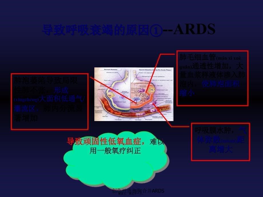 创伤性连枷胸合并ARDS课件_第5页