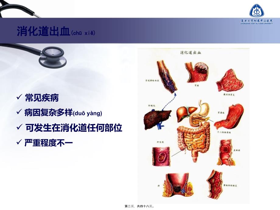 不明原因消化道出血的诊疗进展课件_第2页