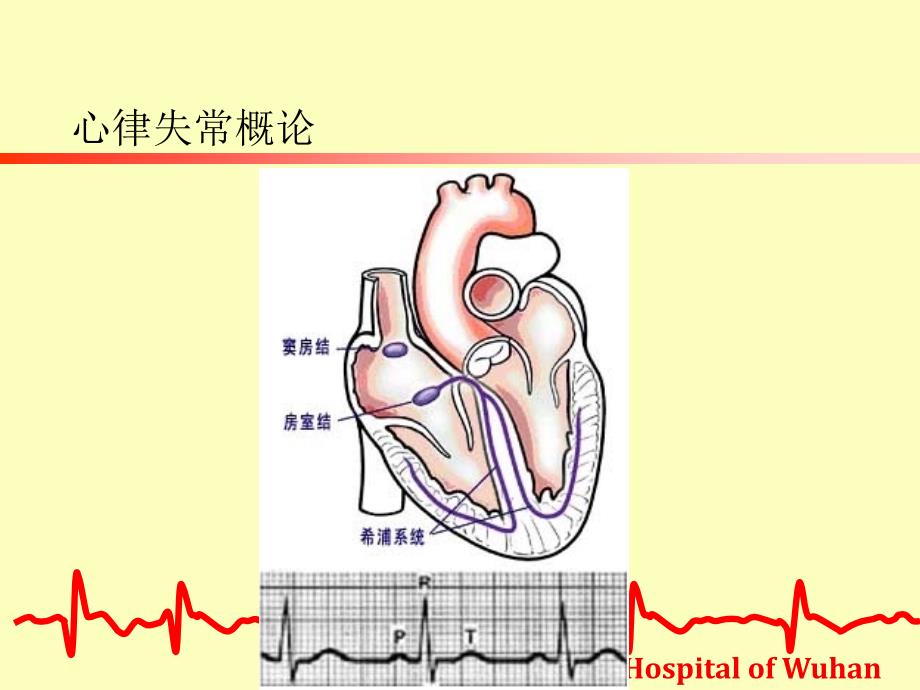 《心律失常的防治》PPT课件_第4页