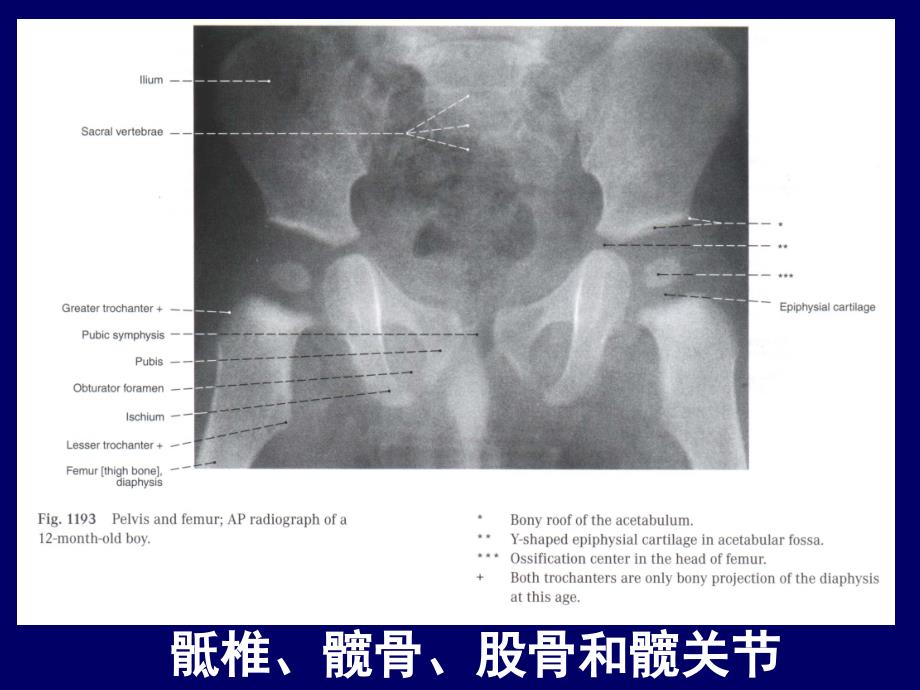 人体断层解剖学下肢的断层解剖PPT课件_第4页