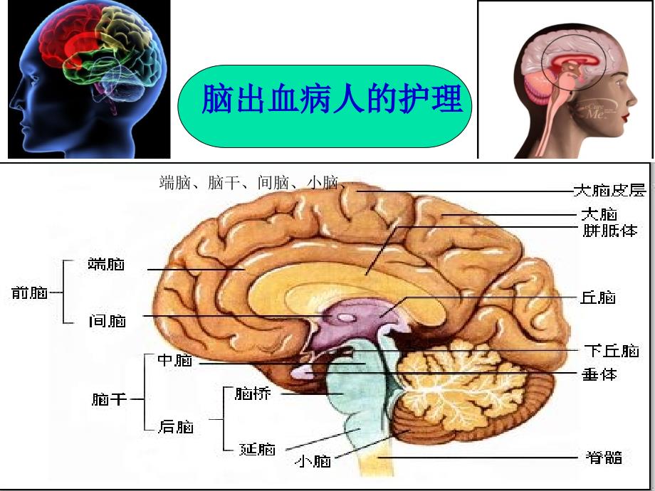 脑出血的护理ppt课件.ppt_第1页