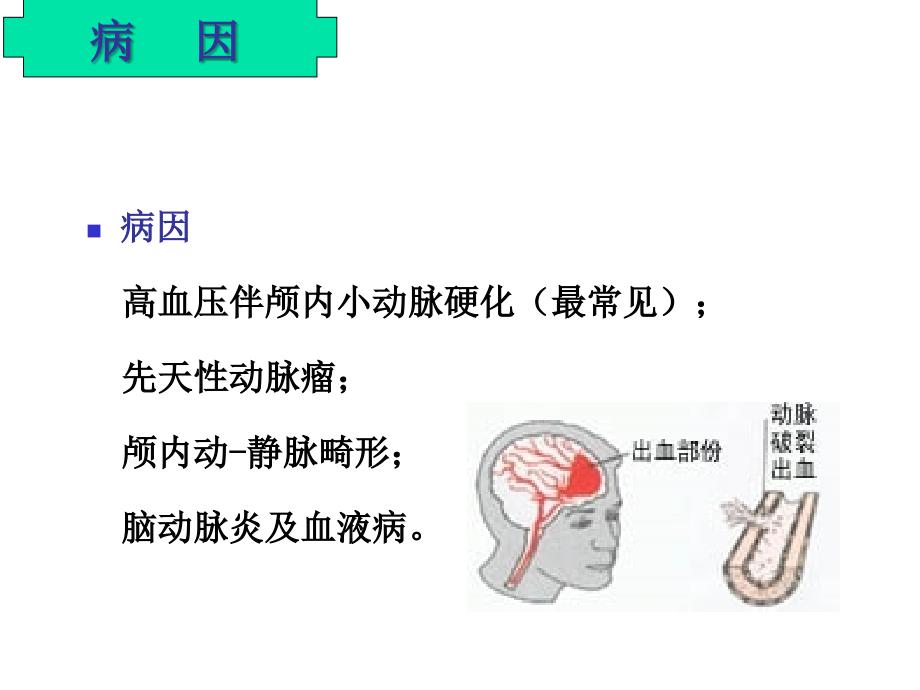 脑出血的护理ppt课件.ppt_第3页