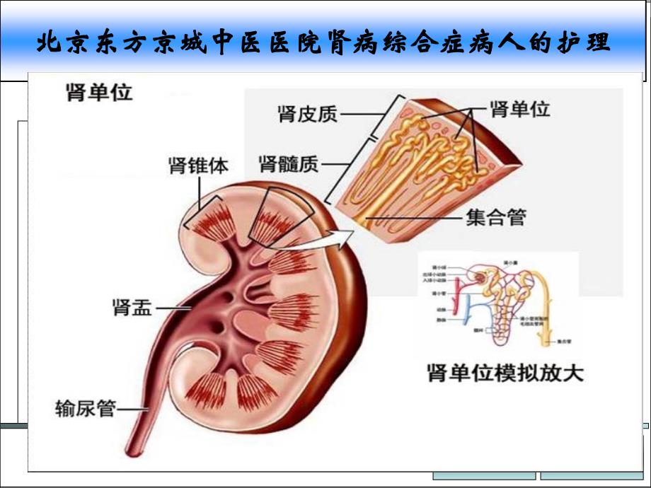 北京东方京城中医医院肾病综合症病人的护理_第1页