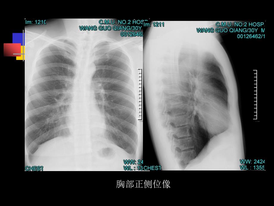 人体形态胸部解剖_第4页