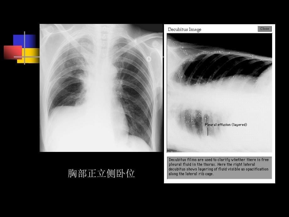 人体形态胸部解剖_第5页