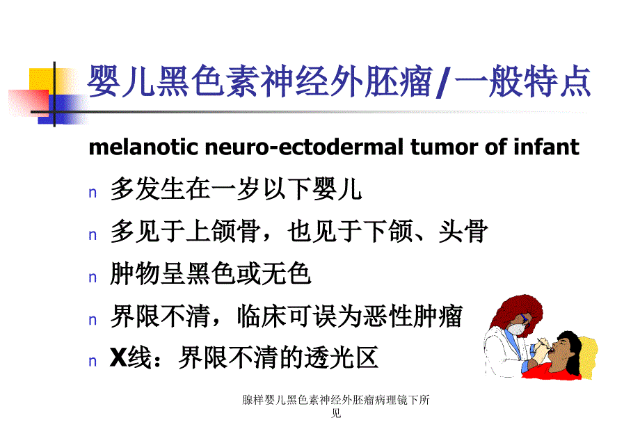 腺样婴儿黑色素神经外胚瘤病理镜下所见课件_第2页