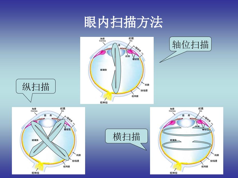 《眼部超声诊断》PPT课件.ppt_第4页