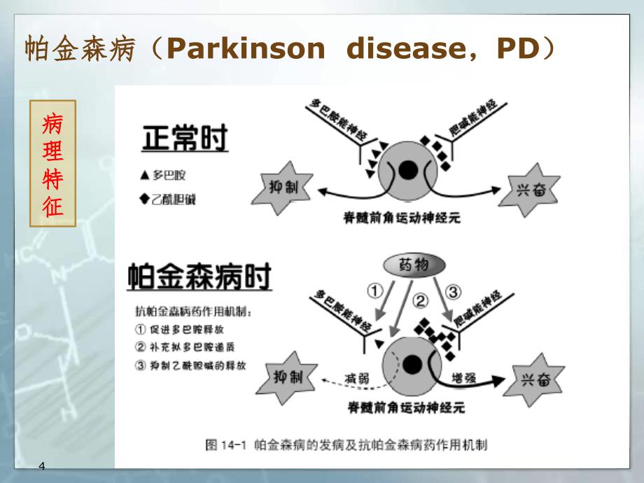 DBS手术护理PPT精选文档_第4页