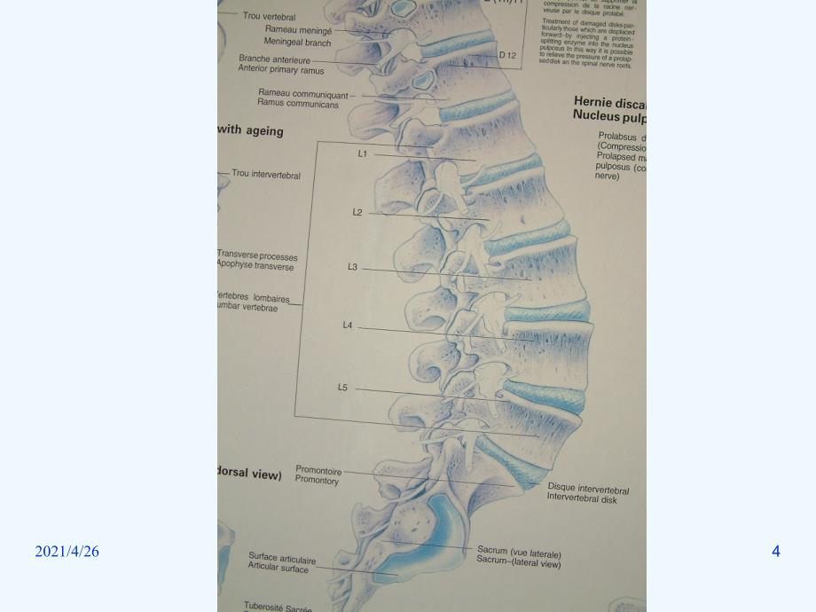腰椎间盘突出症（142页）_第4页