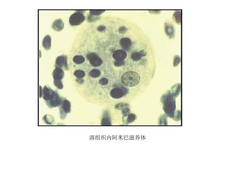 寄生虫学实验考试图1_第2页