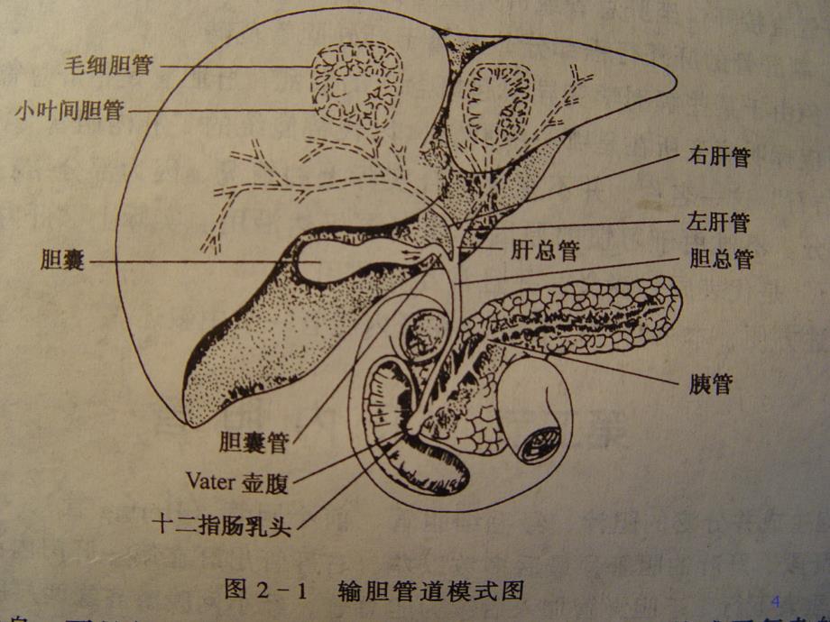 胆石症病人的护理PPT参考幻灯片_第4页