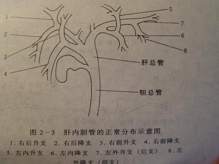 胆石症病人的护理PPT参考幻灯片_第5页