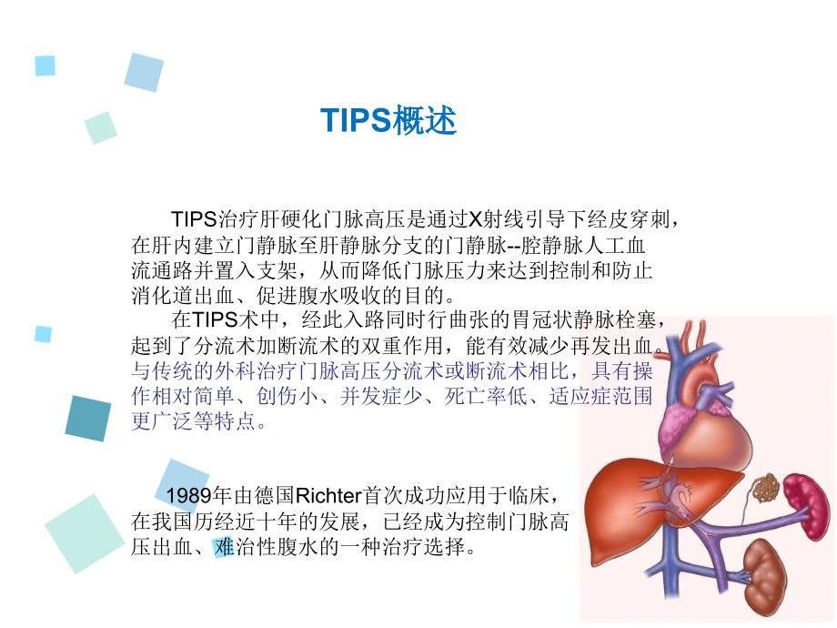 门静脉高压TIPS手术治疗_第2页