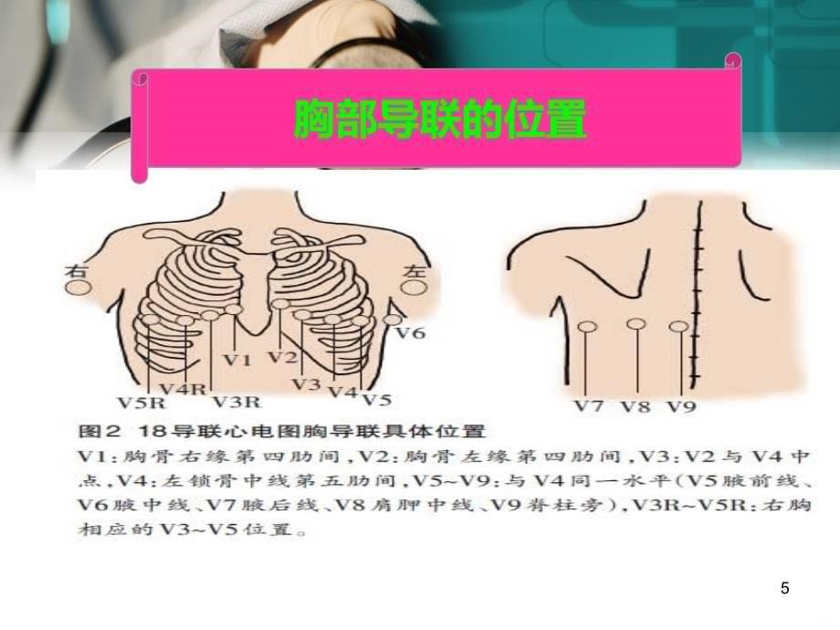 护士如何快速识别异常心电图技巧PPT课件.ppt_第5页