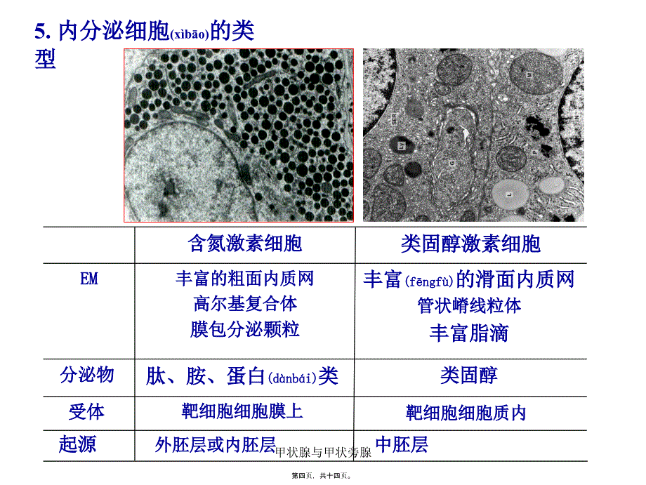 甲状腺与甲状旁腺课件_第4页