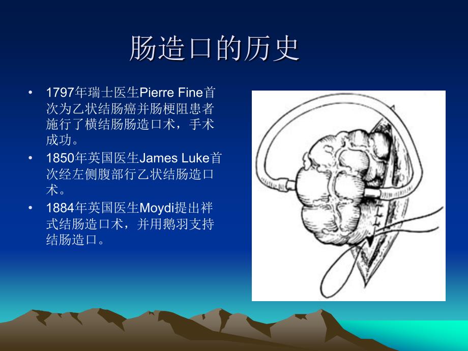 肠造口的护理_第4页