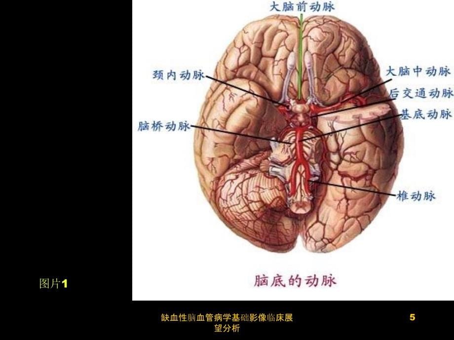 缺血性脑血管病学基础影像临床展望分析课件_第5页