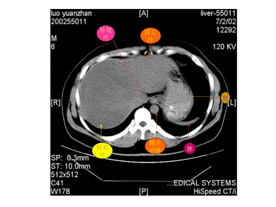 腹部CT断层解剖结构.ppt_第3页