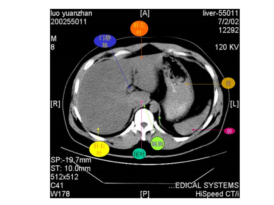 腹部CT断层解剖结构.ppt_第4页