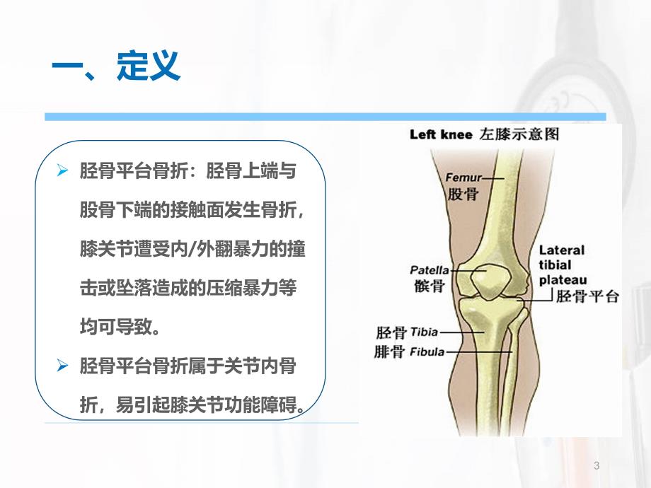 胫骨平台骨折 ppt课件_第3页