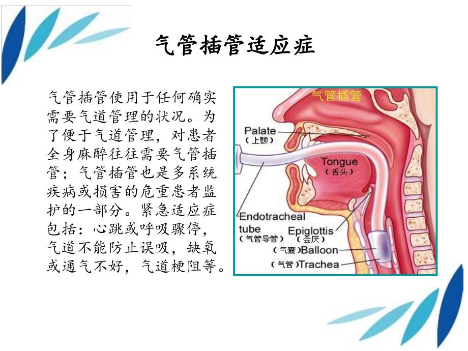 《气道管理》ppt课件_第2页