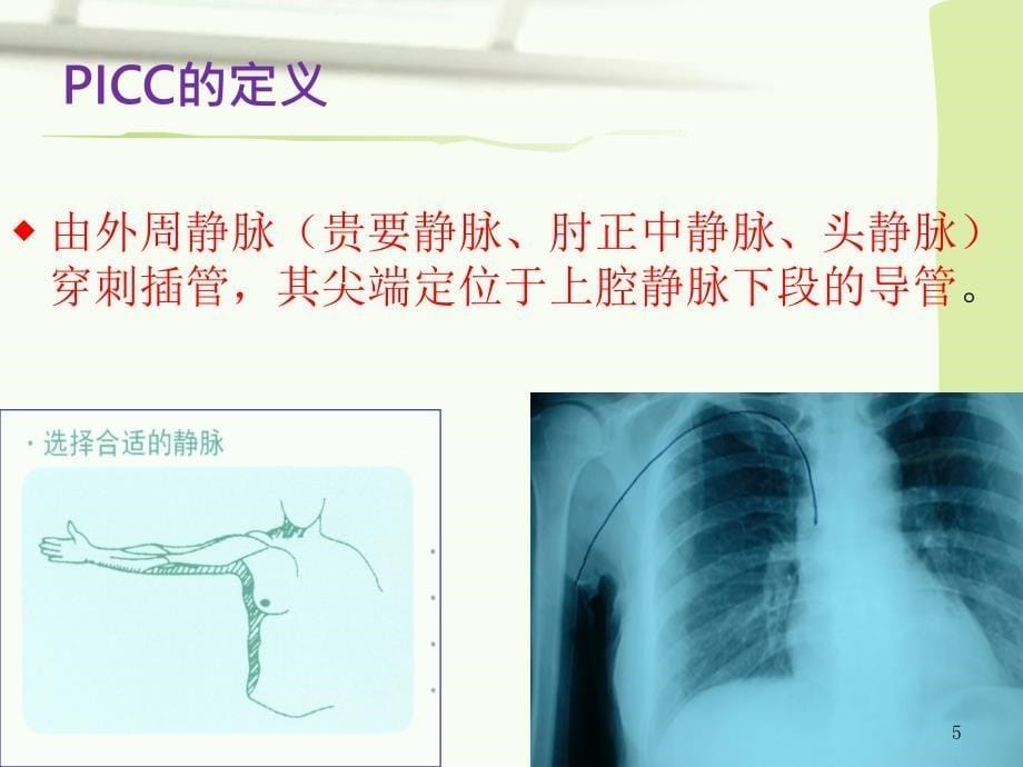 PICC临床应用及护理ppt课件_第5页