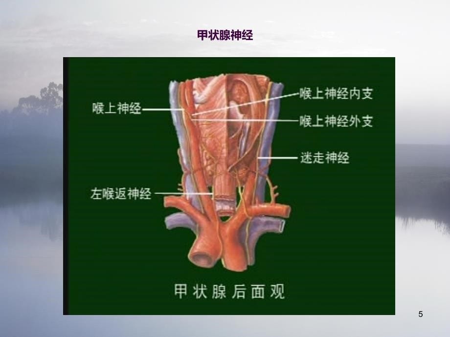 甲状腺术后护理查房ppt课件_第5页