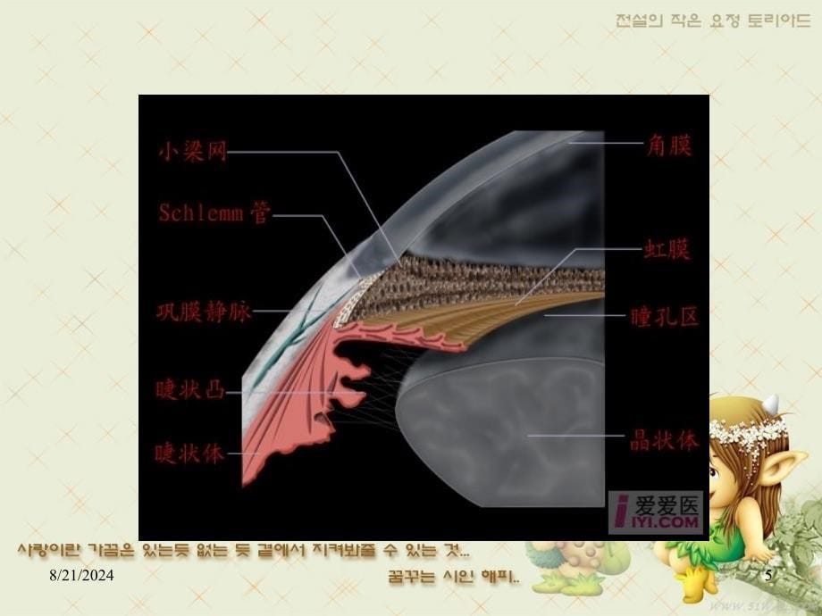 青光眼教学课件_第5页