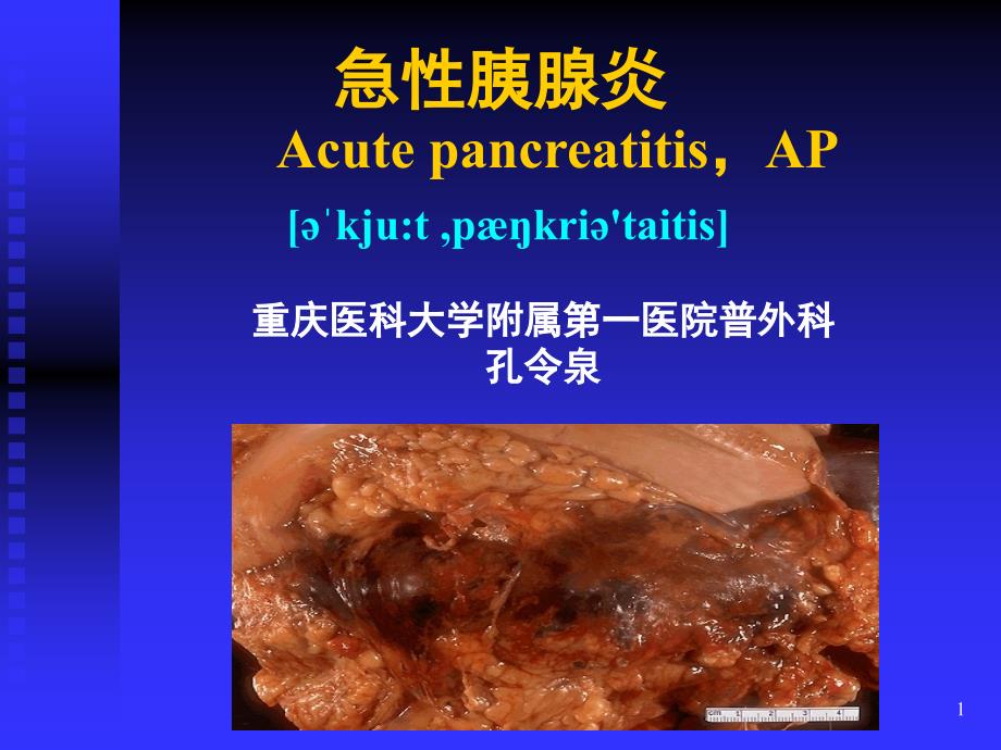 急性胰腺炎优秀课件课堂PPT_第1页