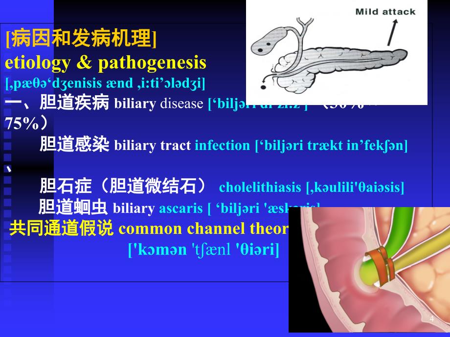 急性胰腺炎优秀课件课堂PPT_第4页