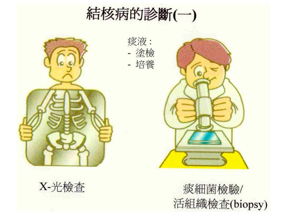 《结核病的诊断》PPT课件_第2页