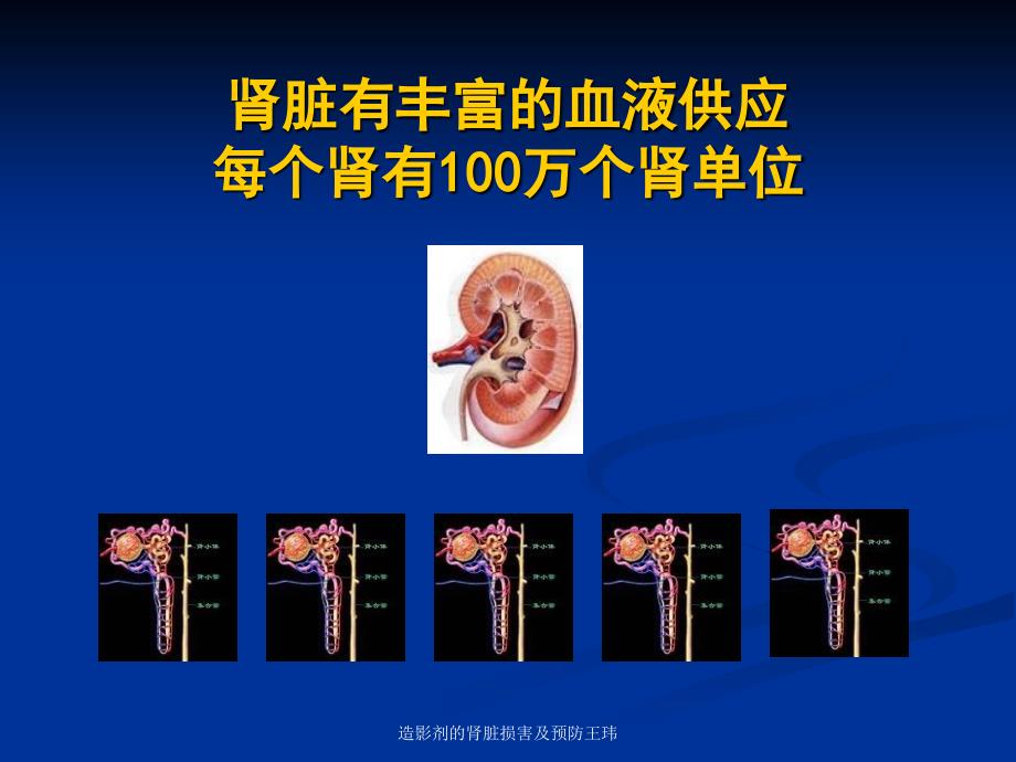 造影剂的肾脏损害及预防王玮课件_第3页