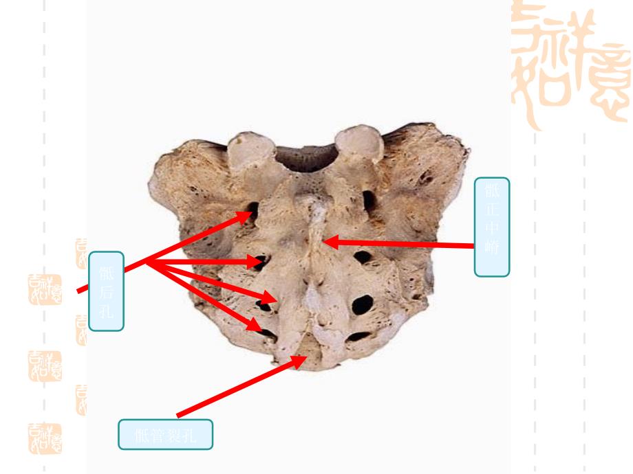 临床本科系统解剖学标本考试_第3页