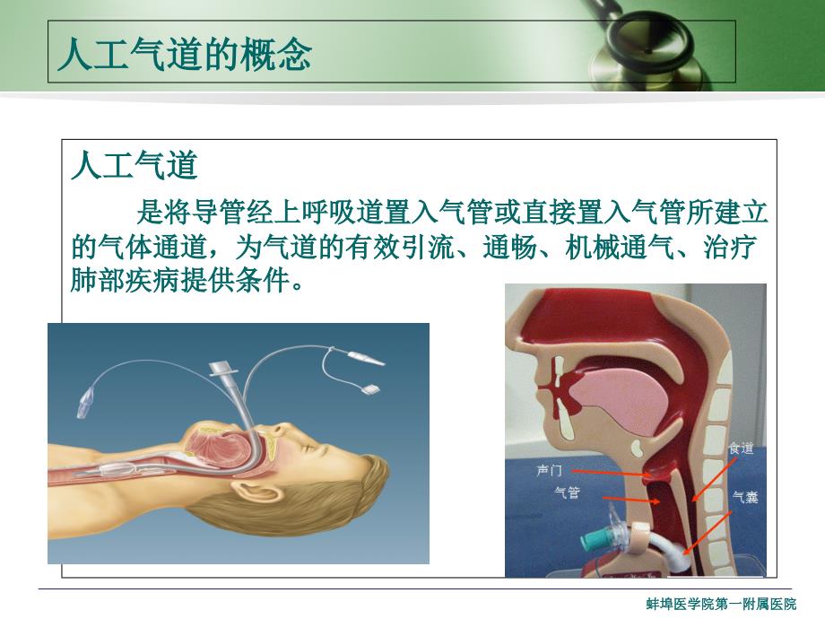 人工气道管理ppt课件_第2页